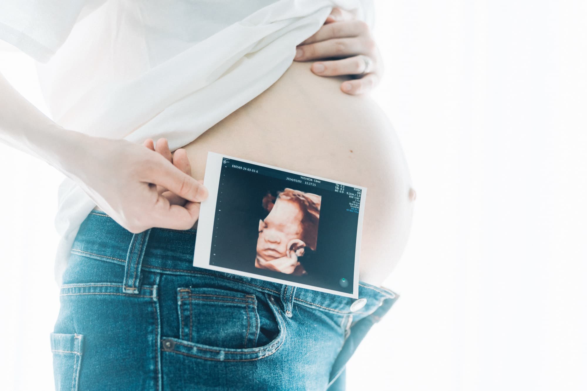 マタニティフォト